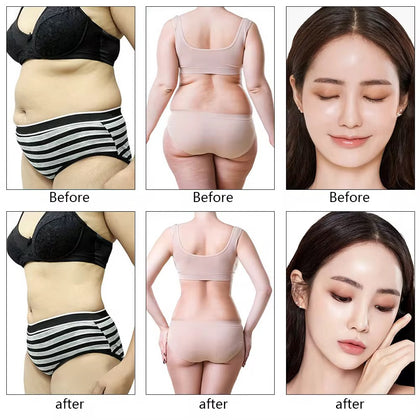 9 in 1 80k Cavitation Machine 2022 Vacuum Cavitation Slimming Equipment Laser Pads Lipo for Slimming Spa – Professional 7-in-1 HydraFacial Machine for Deep Cleansing, Hydration & Anti-Aging